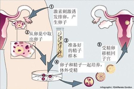 Geri培养箱